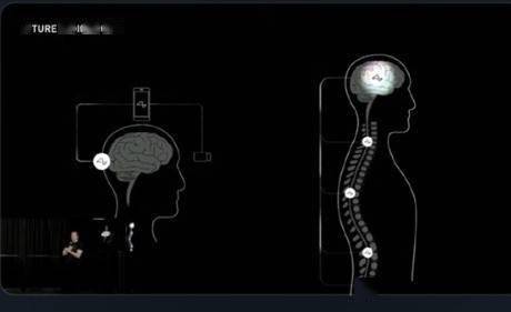 马斯克的脑机接口获批进行人体实验。这可能是人造人的开端？